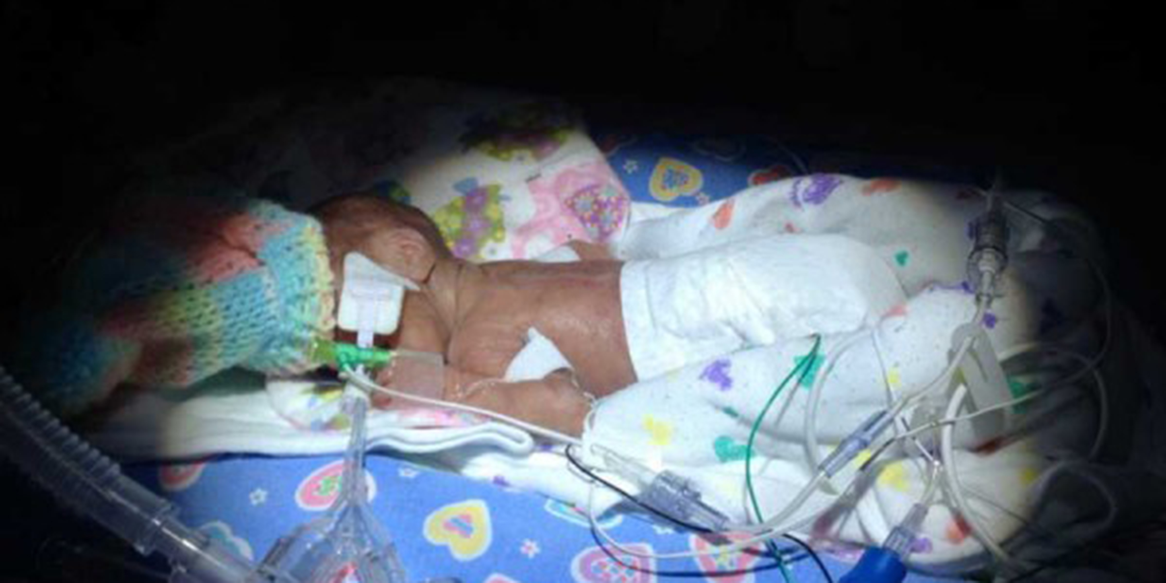 Preemie Power How my daughter's early birth made me stronger